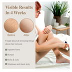 IPL At-Home Hair Removal Device for Women & Men, Permanent Painless Handheld Laser Hair Remover 5 Adjustable Energy Levels, Full Body Hair Removal Machine for Face, Armpits, Bikini Line, Legs