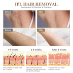 IPL At-Home Hair Removal Device for Women & Men, Permanent Painless Handheld Laser Hair Remover 5 Adjustable Energy Levels, Full Body Hair Removal Machine for Face, Armpits, Bikini Line, Legs